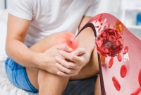 علامات مبكرة تشير لإصابتك بالتهاب المفاصل علامات مبكرة تشير لإصابتك بالتهاب المفاصل