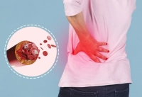 أسباب وانواع التصلب اللويحي المتعدد وطرق علاجها أسباب وانواع التصلب اللويحي المتعدد وطرق علاجها